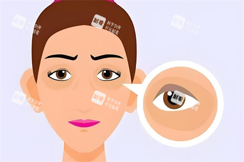 王楊修復眼袋多少錢？2025新收費曝光，從基礎到復雜項目收費明細，不同修復難度報價有差異！